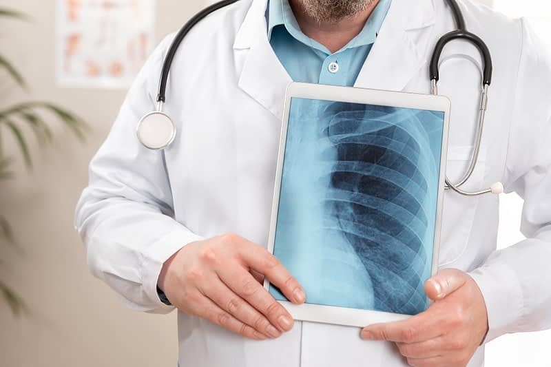 x-ray x-ray